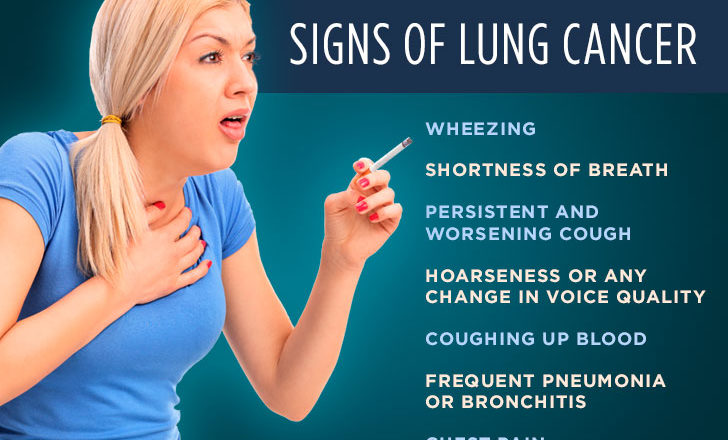 Lung Cancer Symptoms, Causes And Prevention